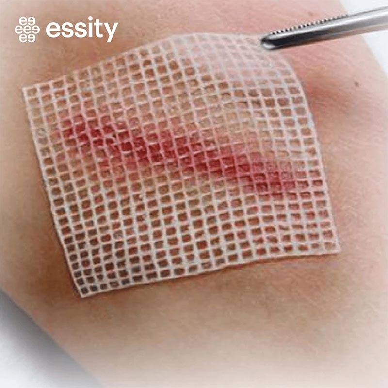Essity Cuticell Classic 10cmx10cm