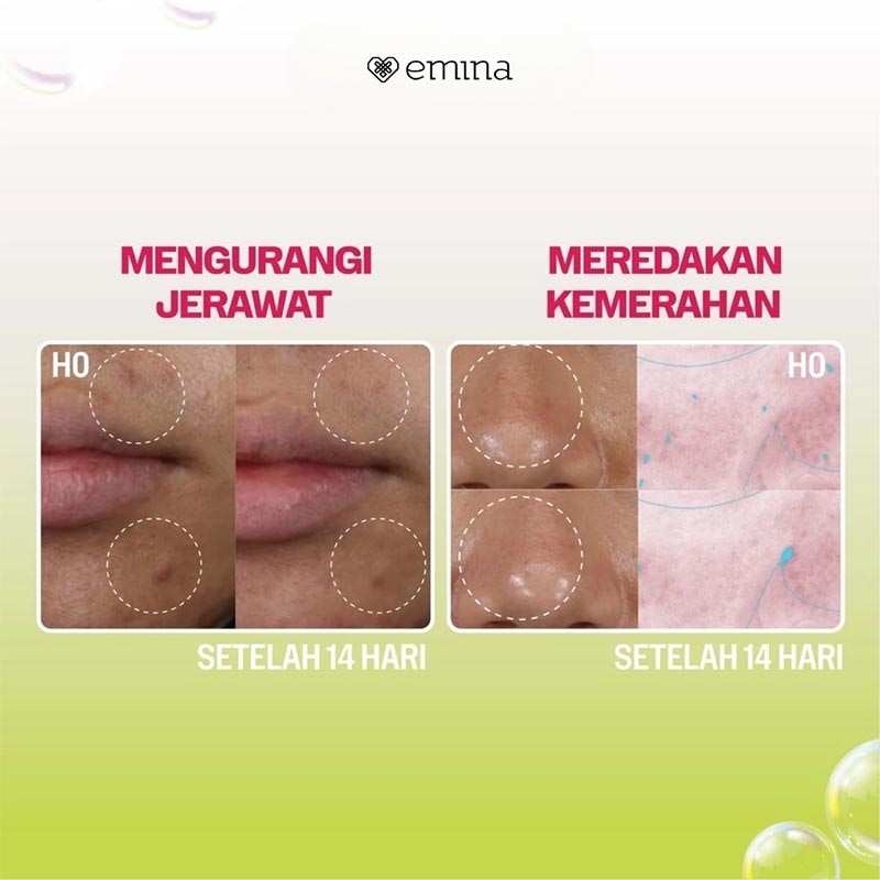 Emina Bright Stuff Prebiotic Tranexamic Acid Brightening Facial Cleanser 50ml