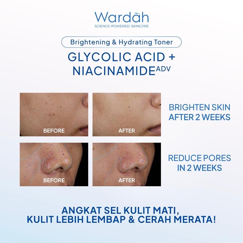 Glycolic Acid Niacinamide ADV Brightening Hydrating Toner 125ml