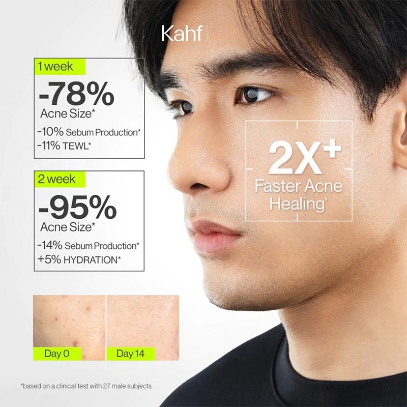 Oil and Acne Care Face Wash 100 ml