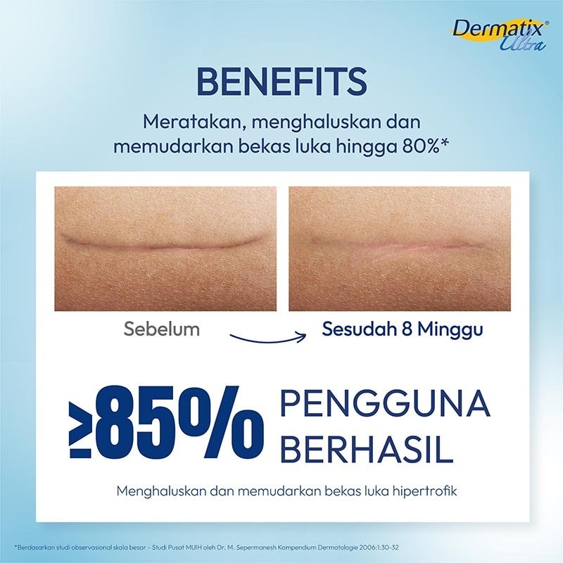 Dermatix Ultra 15g - Merawat dan Memudarkan Bekas Luka