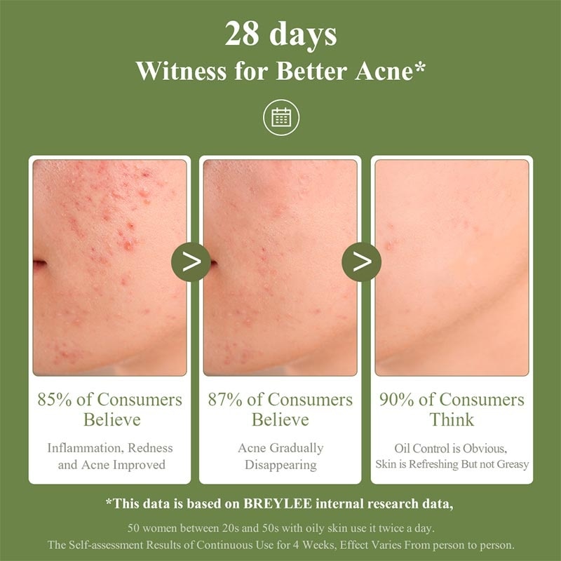 Breylee Acne Treatment Gel 15G