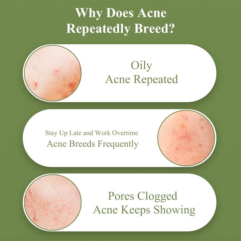 Breylee Acne Treatment Gel 15G