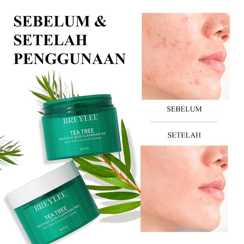 BREYLEE TTREE SAL ACD CLNS PAD 150GR