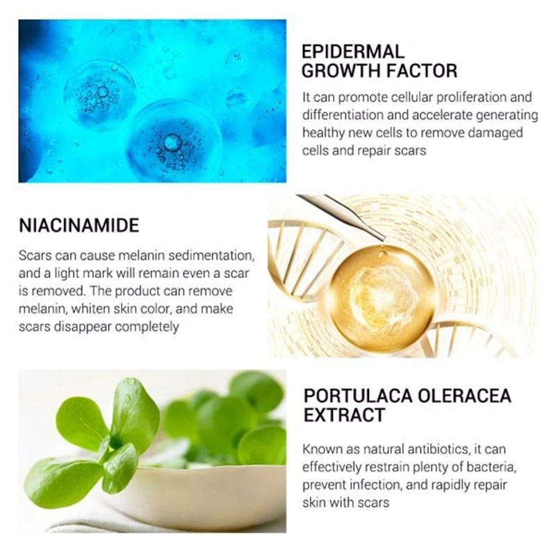 Breylee Acne Cream 30G