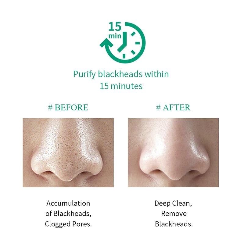 BREYLEE BLACKHEAD MASK (STEP 1) 17ML