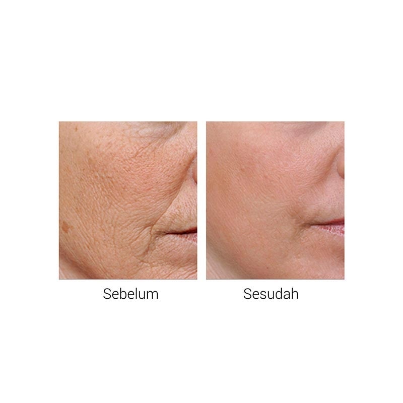 BREYLEE COLL PEPTIDE SERUM F/MASK 25ML