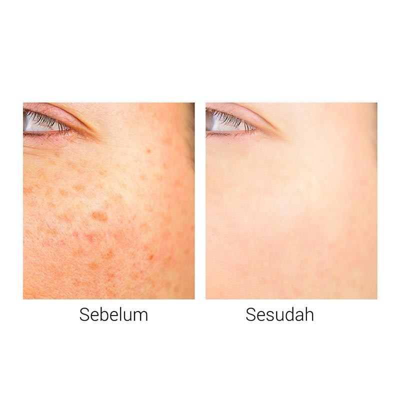 Breylee Soothing 25Ml