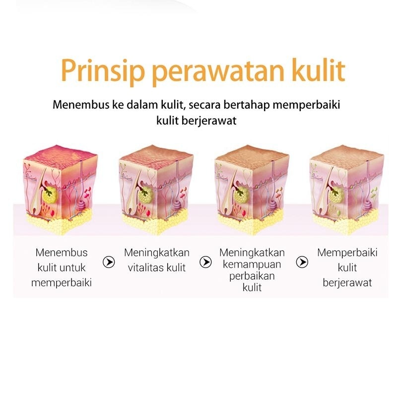 Breylee Acne Treatment 25Ml