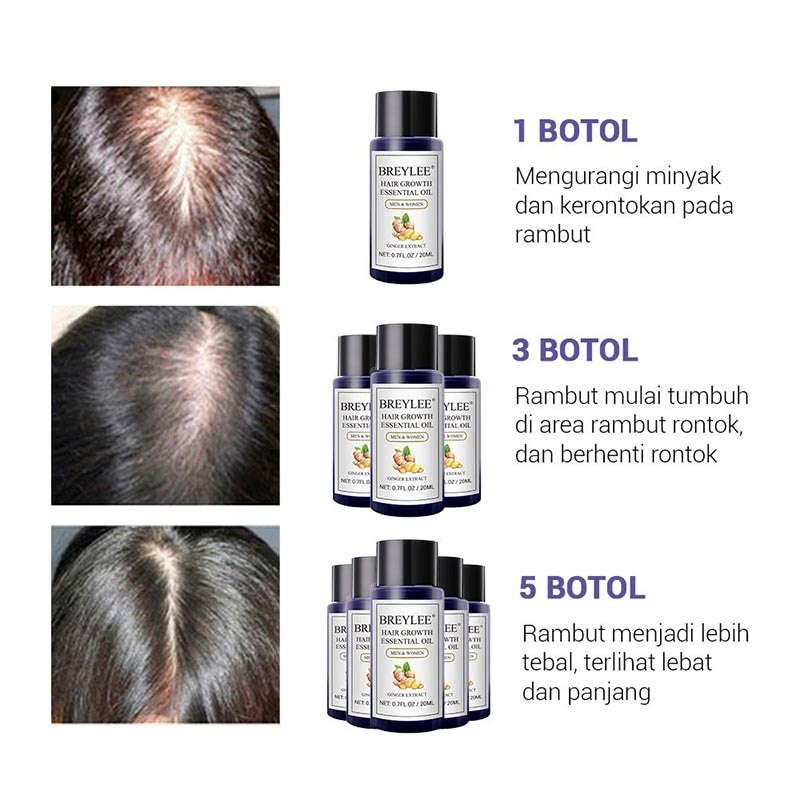 BREYLEE HAIR ESSENTIAL OIL 20ML