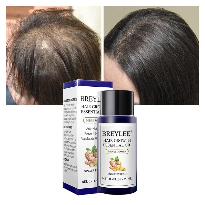 BREYLEE HAIR ESSENTIAL OIL 20ML