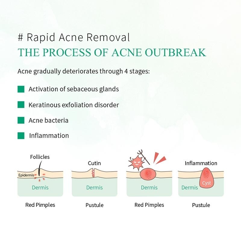 BREYLEE TTREE ACNE TREAT F/CLNSR 100GR