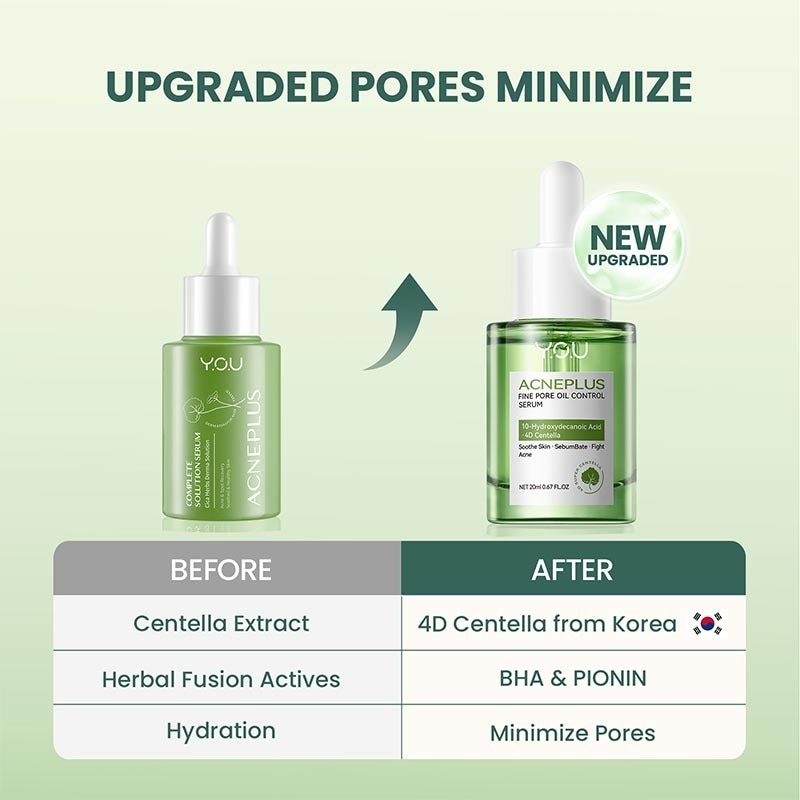 YOU AcnePlus Fine Pore Oil Control Serum 20ml