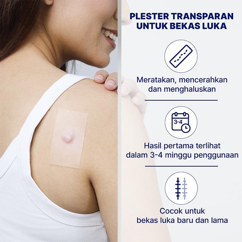 Plester Bekas Luka 21'S