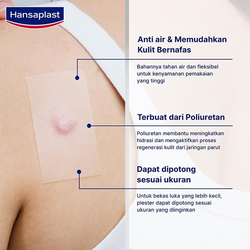 Plester Bekas Luka 21'S