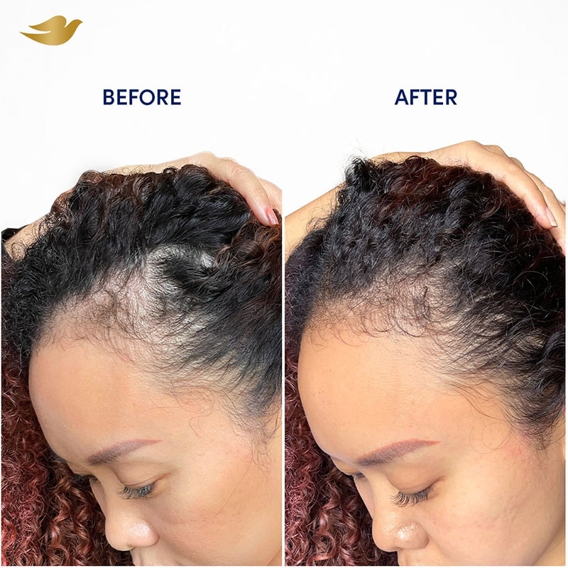 Hair Tonic Spray Perawatan Rambut Rontok 75ml