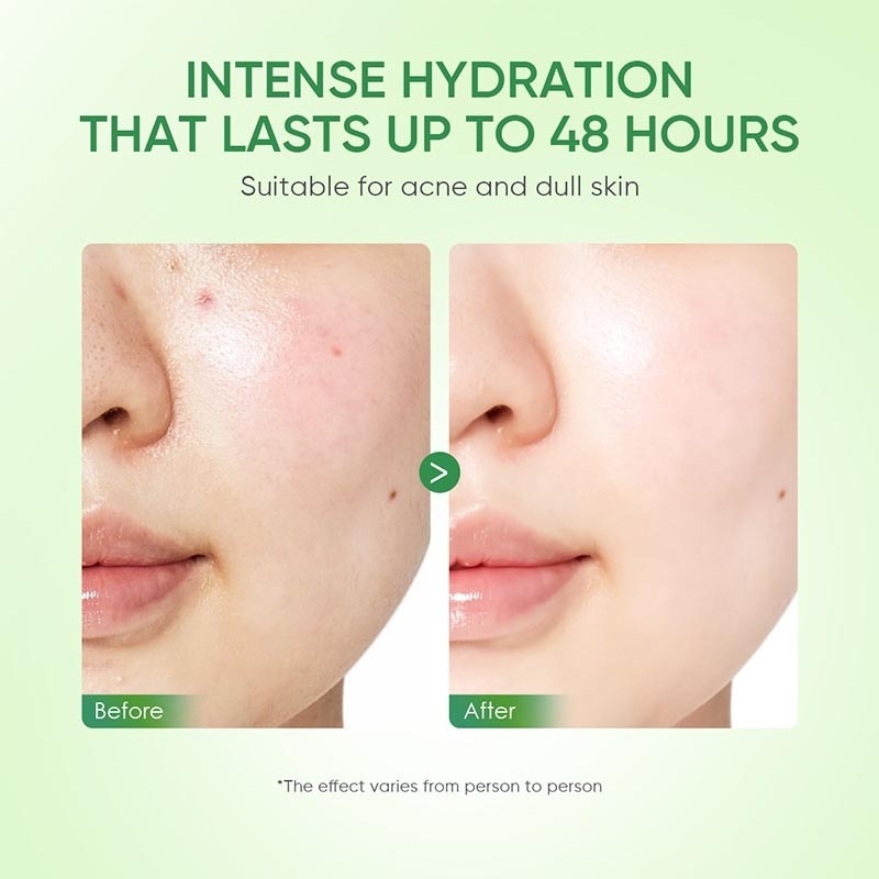 Cica-B5 Soothing Moisturizer 50ml