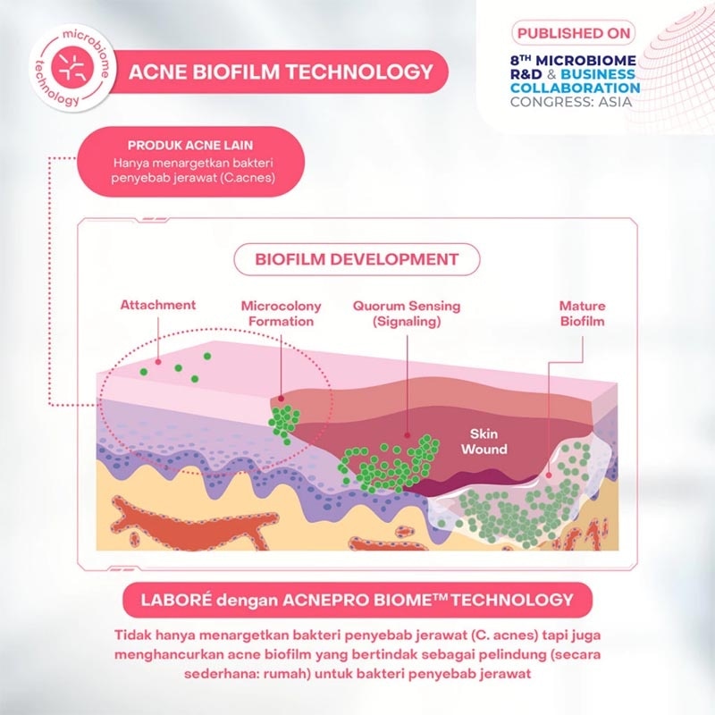 Sensitive Skin Care AcnePro Biome Sebum & Acne Cleansing Mousse 150ml