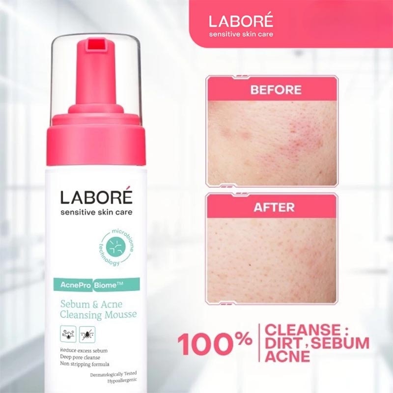 Sensitive Skin Care AcnePro Biome Sebum & Acne Cleansing Mousse 150ml