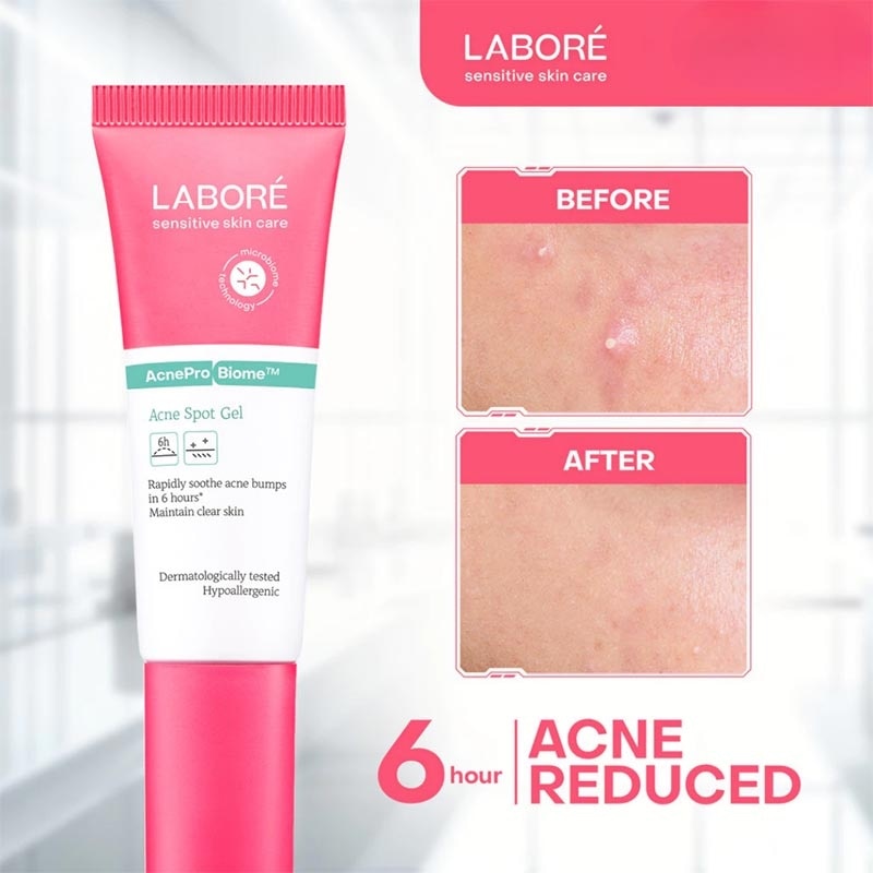 AcnePro Biome Acne Spot Gel 15ml