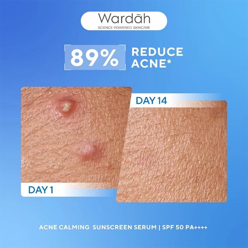 UV Shield Acne Calming Sunscreen Serum SPF 50 PA++++ 25ml