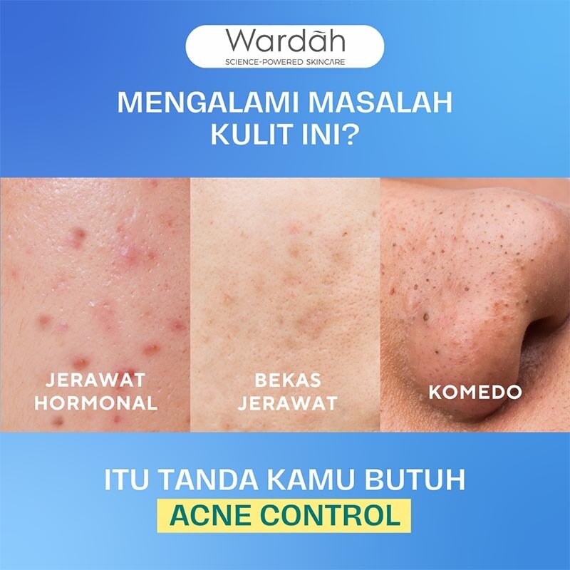 UV Shield Acne Calming Sunscreen Serum SPF 50 PA++++ 40ml