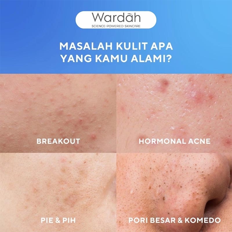 UV Shield Acne Calming Sunscreen Moisturizer SPF 35 PA+++ 35ml