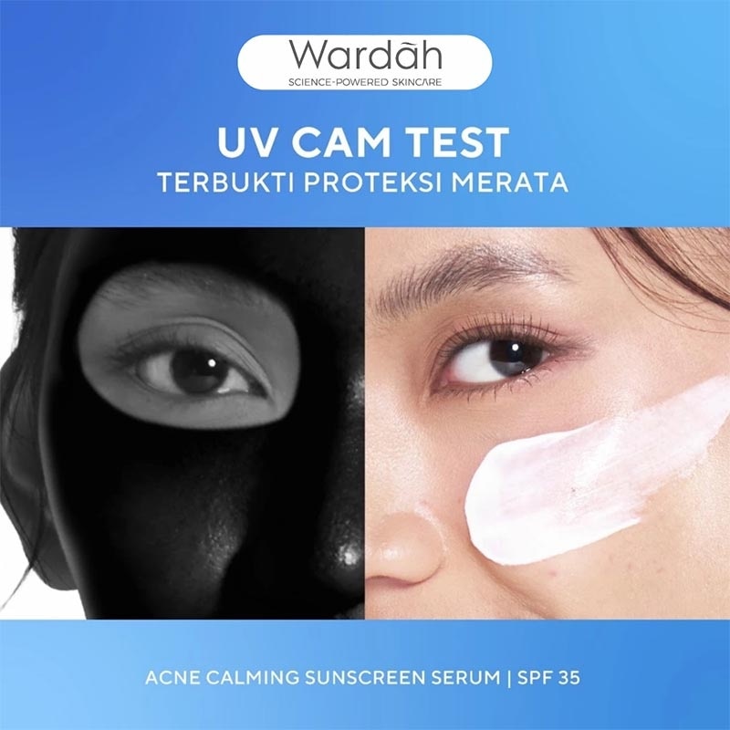 UV Shield Acne Calming Sunscreen Moisturizer SPF 35 PA+++ 35ml