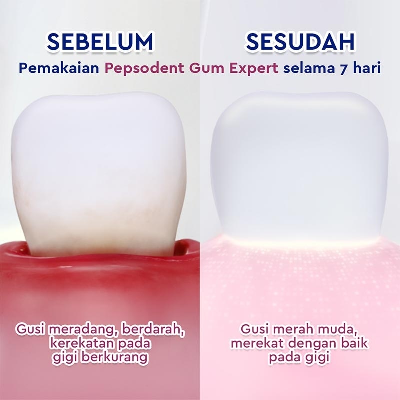 Pepsodent Pasta Gigi Gum Expert Fresh 100g