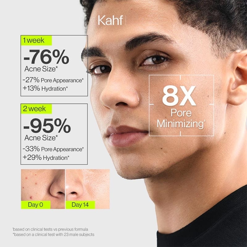 Acne and Pore Cleanse Scrub Face Wash 100 ml