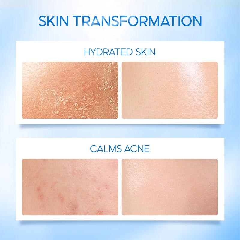 Intensive CeraHydro Barrier Repair Moisture Gel 50ml