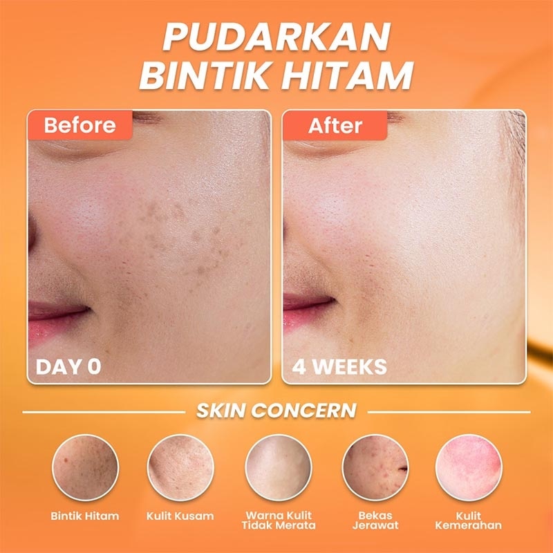 Hanasui Vitamin C Serum Renew 20ml