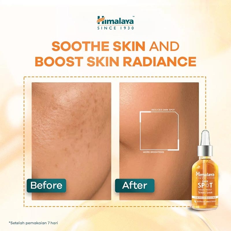 Turmeric Dark Spot Face Serum 15ml