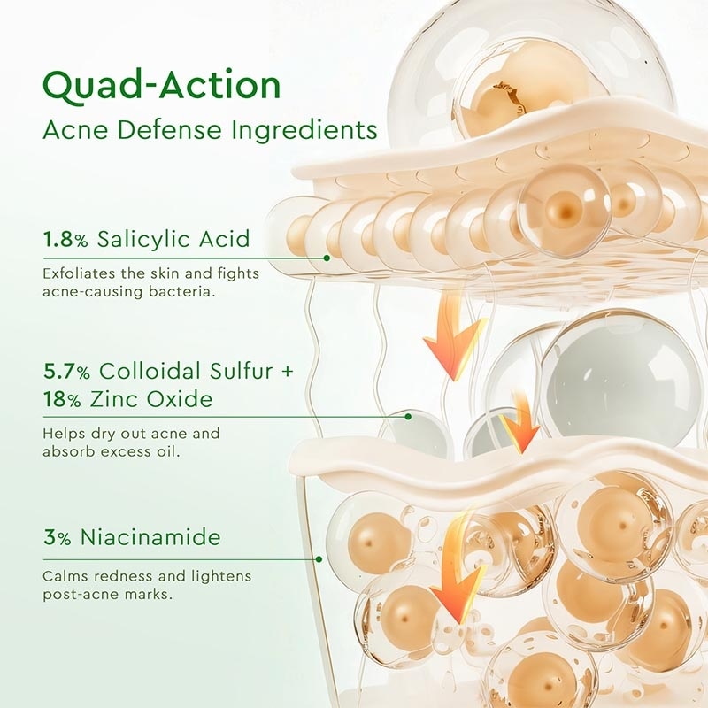 Glad2Glow Acne Drying Lotion 10ml
