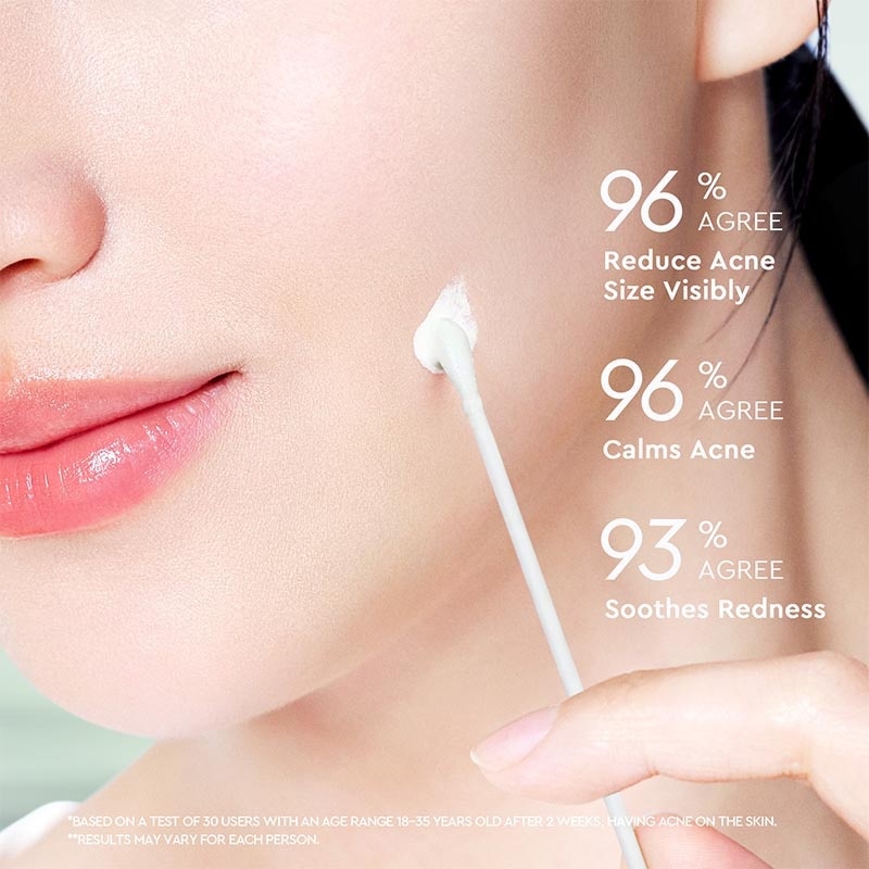 Glad2Glow Acne Drying Lotion 10ml