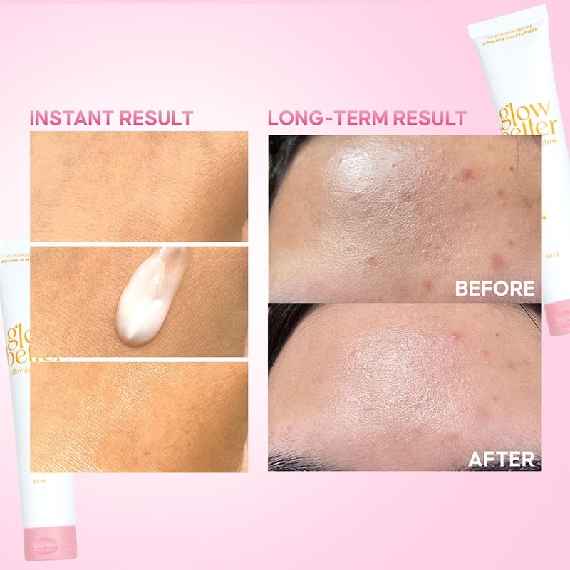 Glow Better Effortless Glow Cloud Skin Recipe Advanced Moisturizer 50g