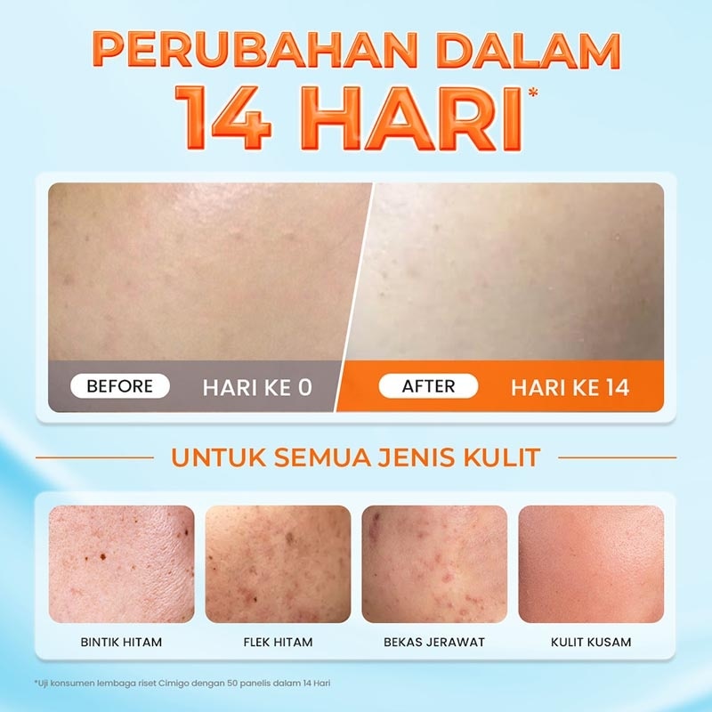 Hanasui Bright Expert + Tranexamic Acid Moisturizer Gel 30g