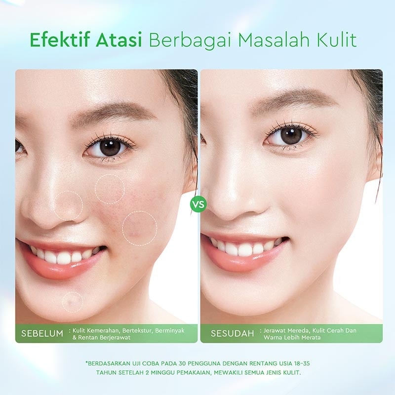 Glad2Glow Centella Salicylic Acid Exfoliating Acne Pads 30'S