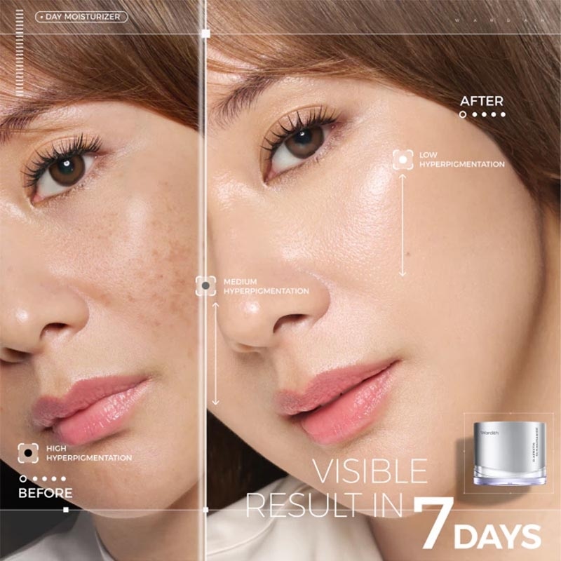 Wardah Crystal Secret a-Arbutin 5% Niacinamide Hyperpigmentation Expert SPF 35 PA+++ Day Moisturizer 30g