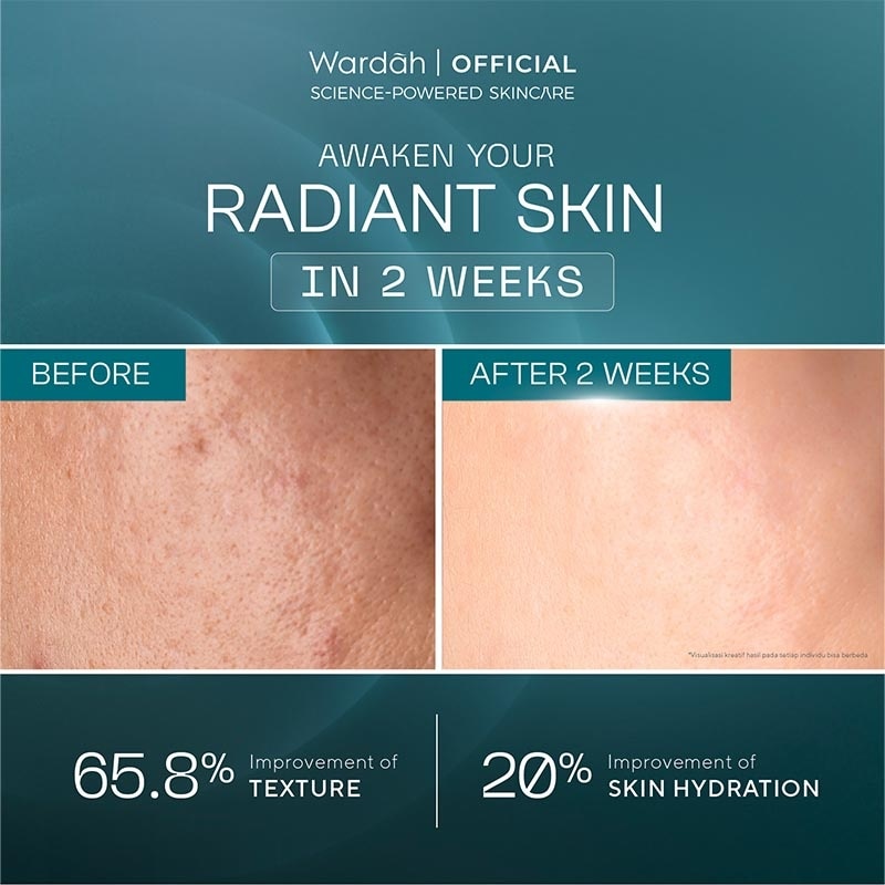 Wardah Radiant Resurfacing Retinal Cysteamine Serum 30ml - Serum pencerah