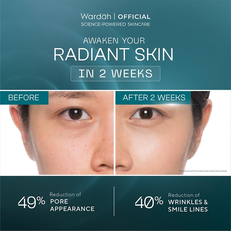 Wardah Radiant Resurfacing Retinal Cysteamine Serum 30ml - Serum pencerah