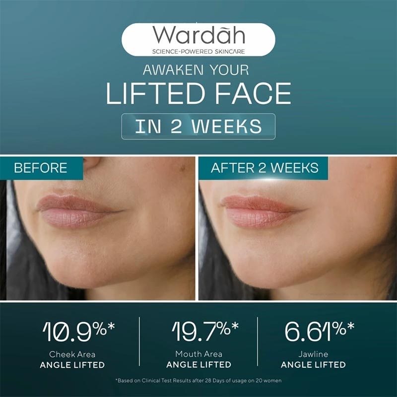 Wardah EXOSOME + PDRN Lift Regenerating Serum 30ml