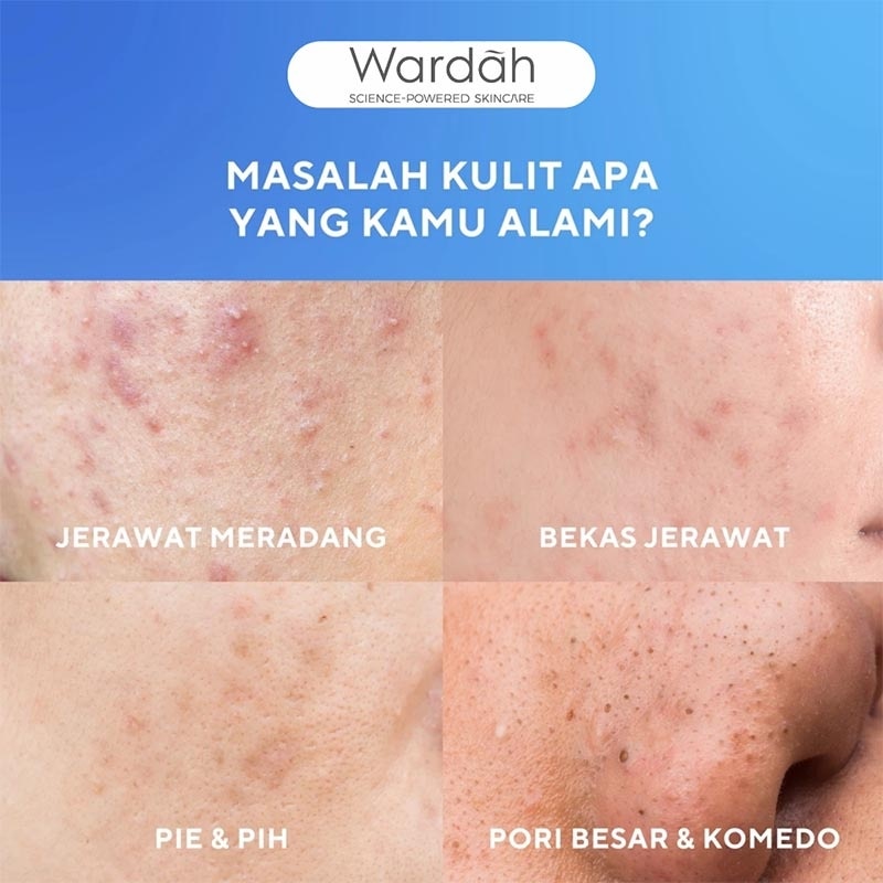 UV Shield Acne Calming Sunscreen Serum SPF 50 PA++++ 100ml