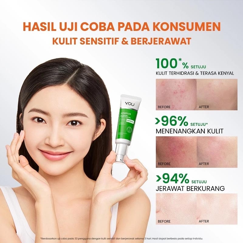 Y.O.U AcnePlus B5 Barrier Moisturizer Gel 30g