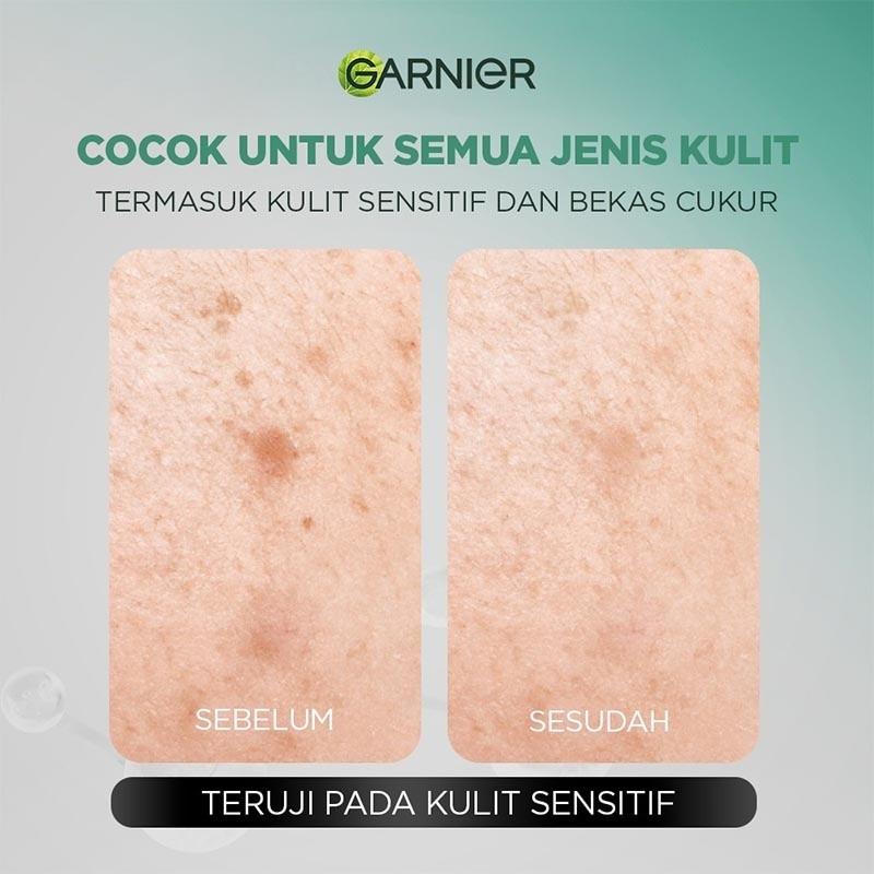 Men AcnoFight Acne Calming Gentle Low PH Gel Cleanser 100ml