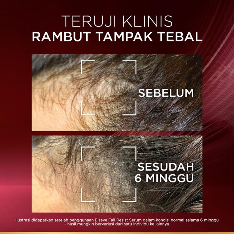 Elseve Aminexil Serum - Anti Hair-Fall Serum 102ml