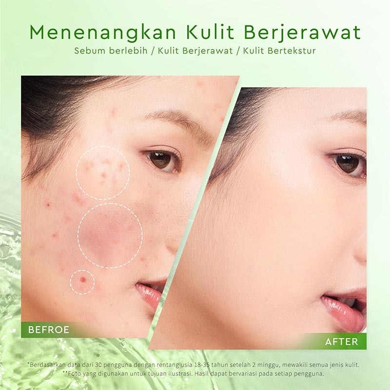 Glad2Glow Mugwort Acne Gel Mask 50g