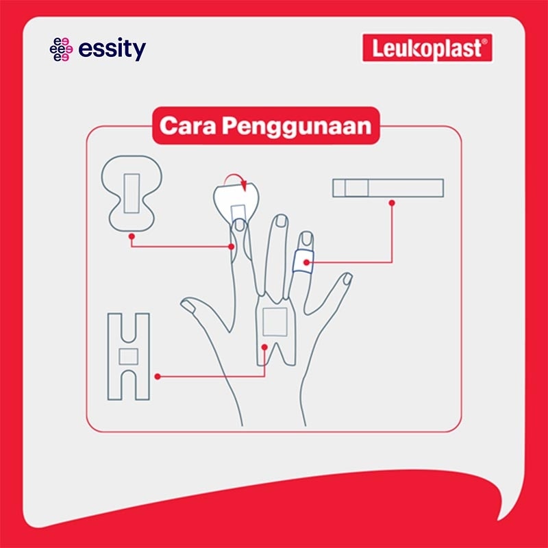 Leukoplast Elastic Assorted Mix 6'S