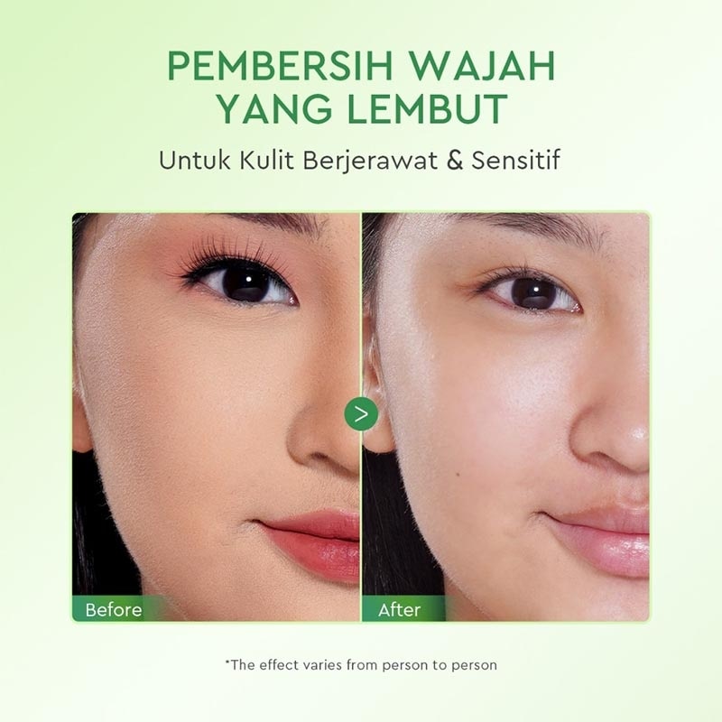 Hyalu-BHA Micellar Water 300ml