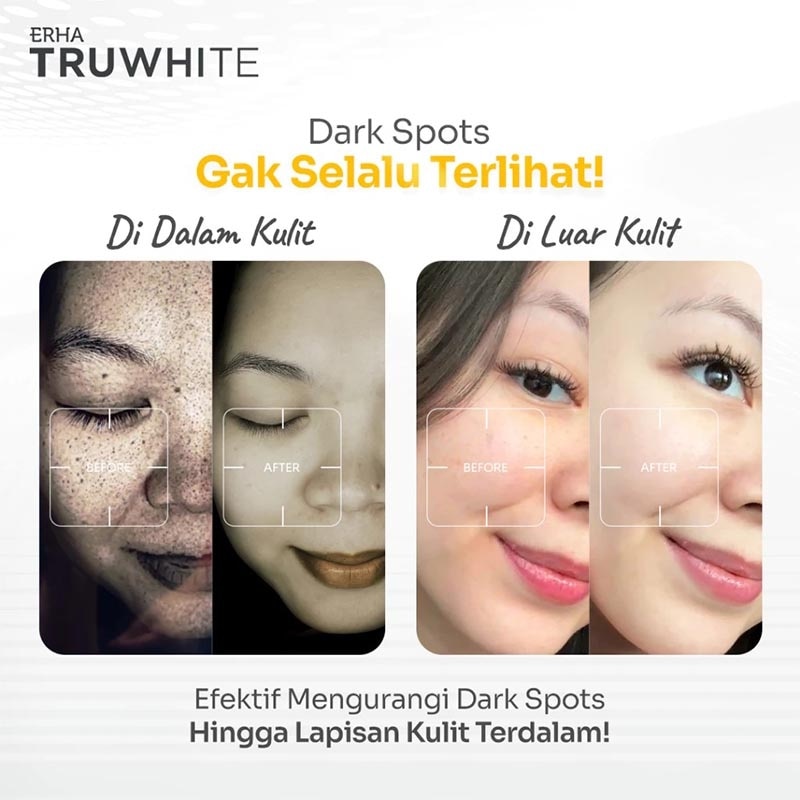 ERHA TRUWHITE ACT GLOW BOOSTER 15ML NEW